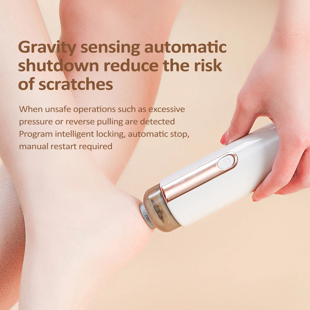 Pro Pedicure Roller: Get salon-smooth feet at home! Electric callus remover for soft, beautiful feet. Step confidently into sandal season!