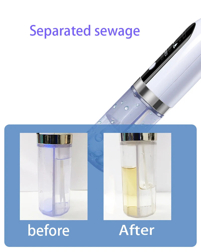 Yavani Beauti Product Facial Lift Face Cleaner Electric Micro Small Bubble Water Cycle Acne Pimple Pore Vacuum Blackhead Remover