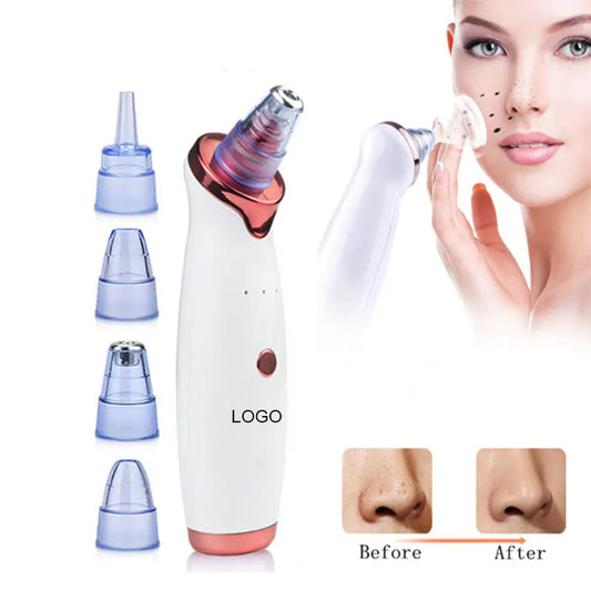 Yavani Beauti Products Facial Lift Electric Pimple Pore Cleaner Nose Ance Vacuum Blackhead Remover